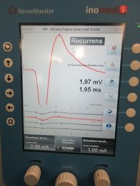 Neuromonitoring
